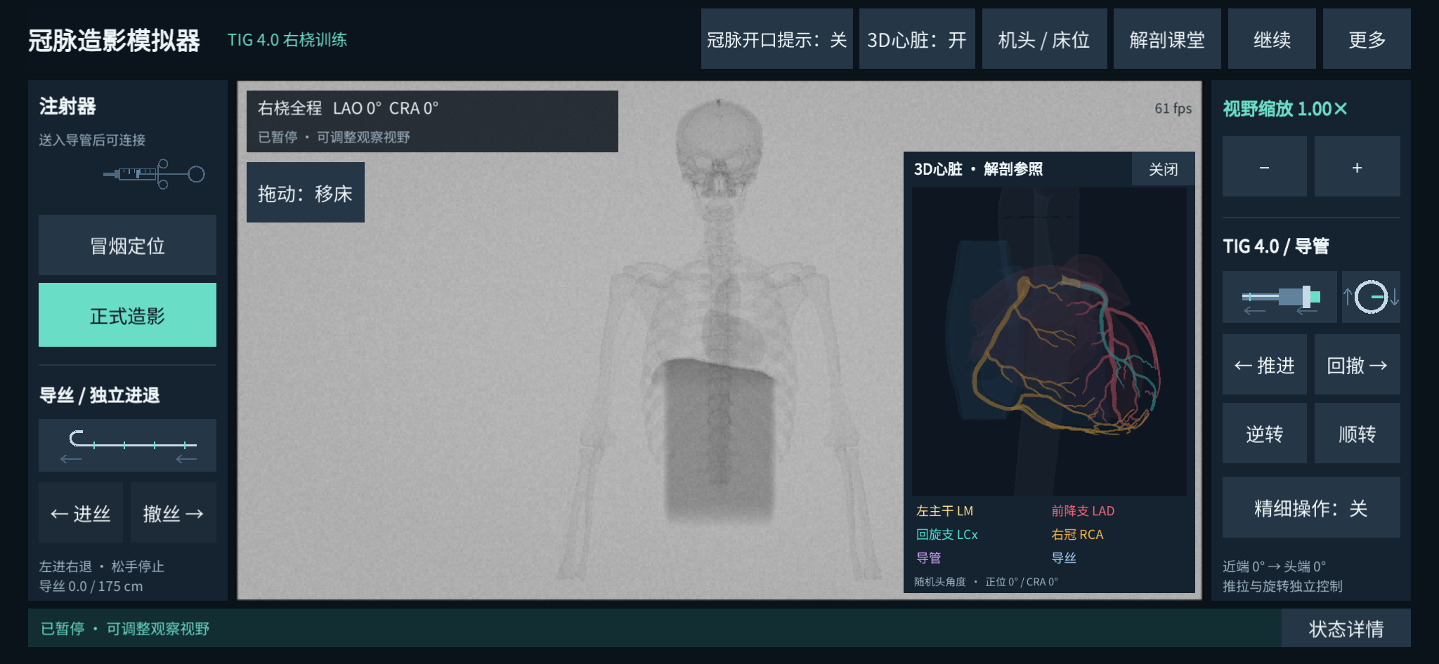 开发版界面：模拟造影视窗、器械控制与三维心脏参考